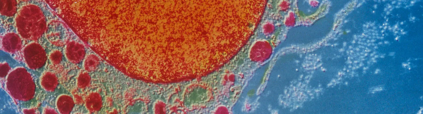 "Inflammaging" - the chronic, low-grade inflammation associated with aging - can silently impact your overall health. This persistent immune response, closely linked to obesity and poor gut health, can disrupt your body's natural healing abilities and accelerate aging.  The Complete Body Analytics™ Test measures your Inflammatory Activity score and identifies key markers affecting your health. Our personalised recommendations target both immediate inflammatory responses and underlying gut health issues, helping restore your body's natural resilience and healthy aging processes.  Transform your health by addressing inflammaging at its root.