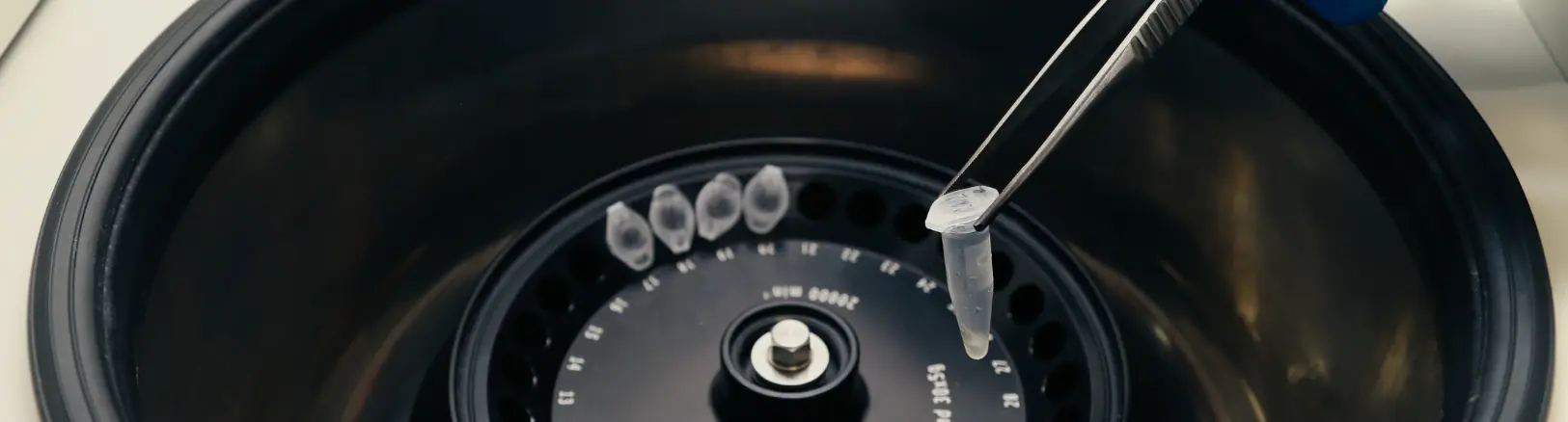 gene expression testing